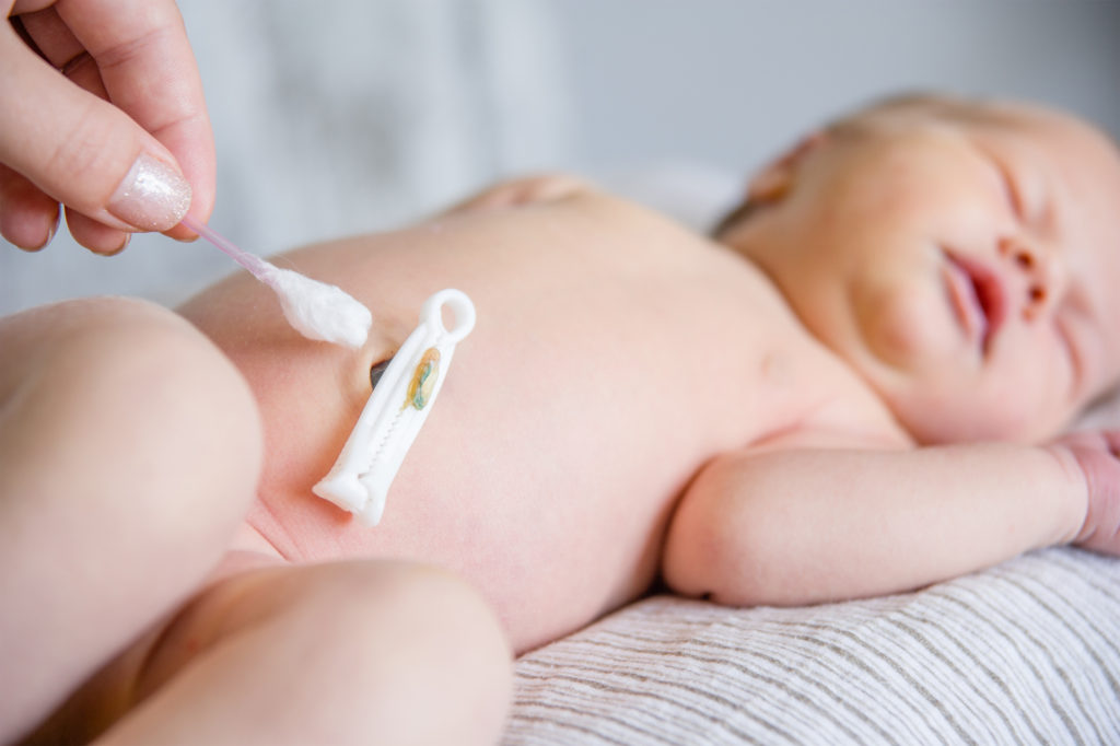 newborn umbilical cord care | Jax, FL Baby Nurse